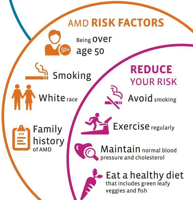 Learn how to prevent age-related macular degeneration